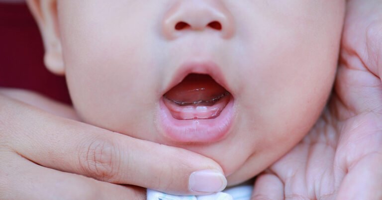 ¿Cómo aliviar el dolor de dientes en bebés?
