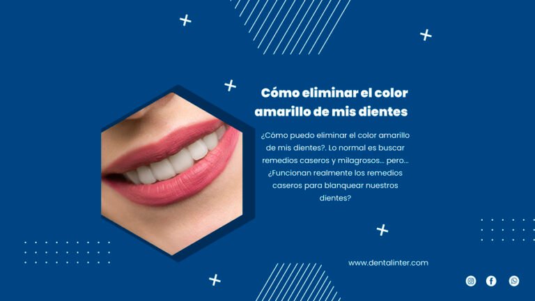Cómo eliminar el color amarillo de mis dientes