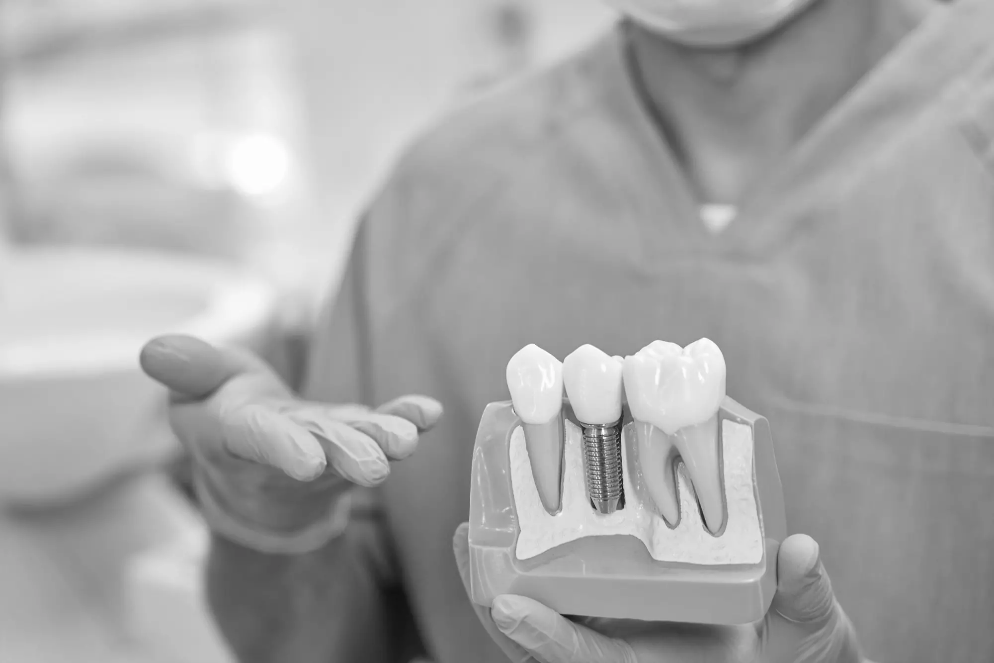 Modelo de implante dental con corona mostrado en la clínica