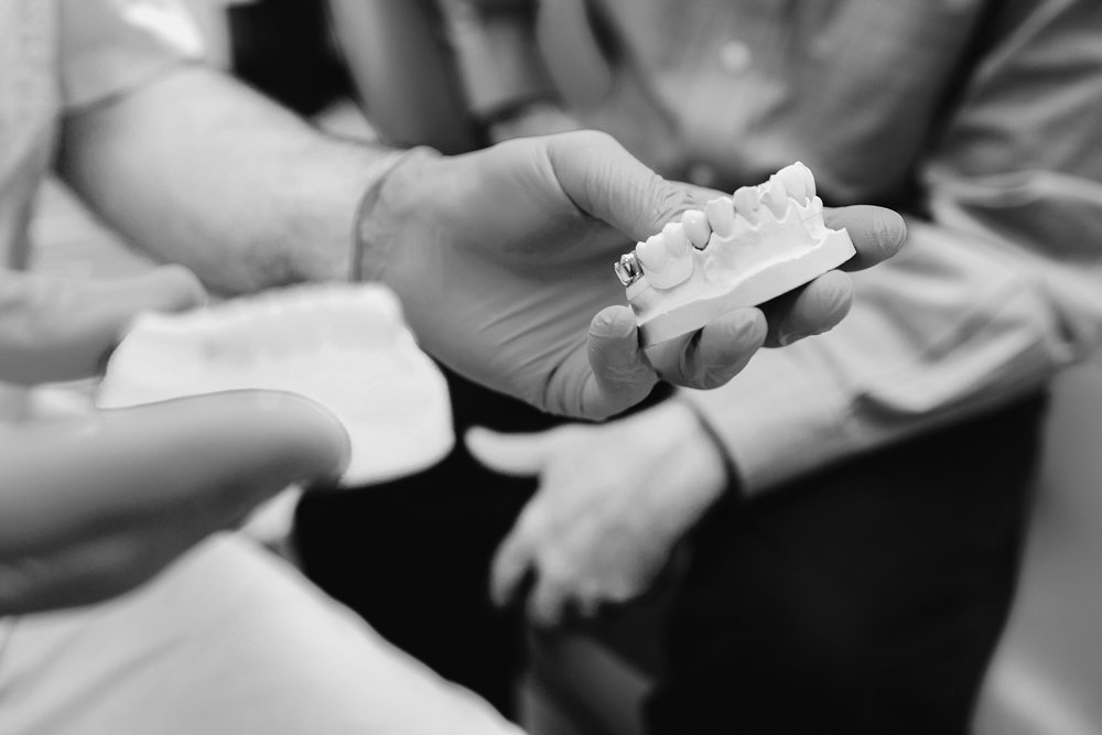 Corona sobre implante dental en Dental Internacional, Tenerife