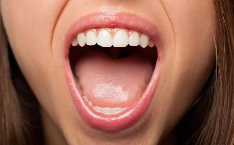 Enfermedades de la lengua más comunes
