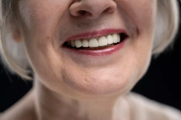 Implantes dentales que se mueven: causas y soluciones
