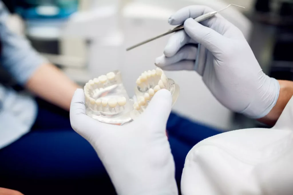 Implantes dentales lo que no te cuentan