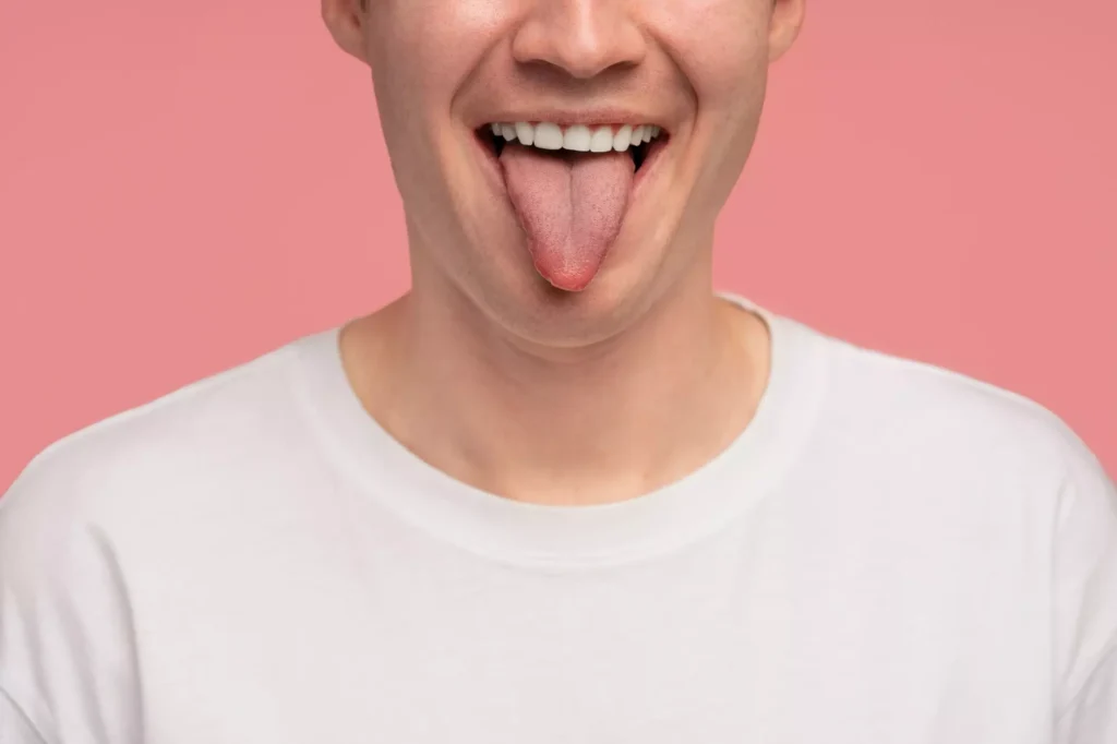 lengua blanca por estrés