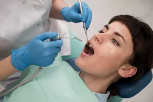 Curetaje dental en clínica